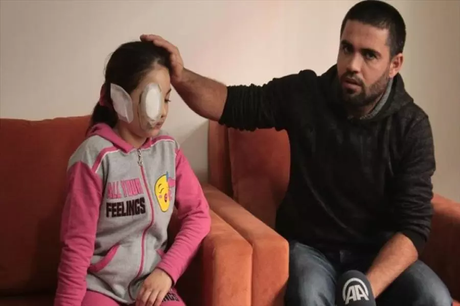 "لجين" طفلة سورية أفقدتها براميل الأسد جمالها وتسعى لاستعادته في تركيا