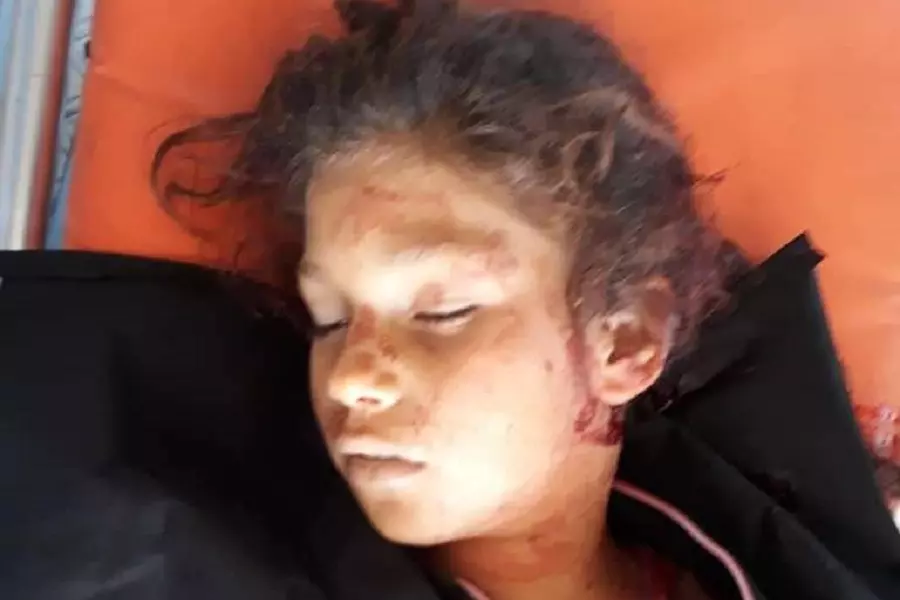 استشهاد طفلة برصاص قناصة النطام قرب مدينة الباب شرقي حلب