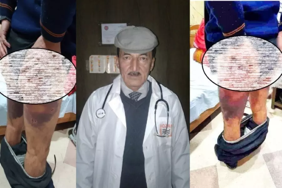 "فيلق الشام" يوضح ملابسات اختطاف طبيب بمدينة عفرين ويؤكد جاهزيته لمحاسبة المتورط بالقضية من عناصره