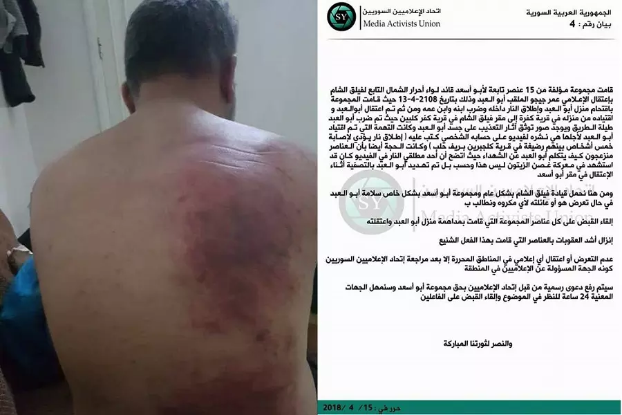 اتحاد الإعلاميين السوريين يستنكر تعذيب الناشط "عمر جيجو" من قبل عناصر لفيلق الشام شمال حلب