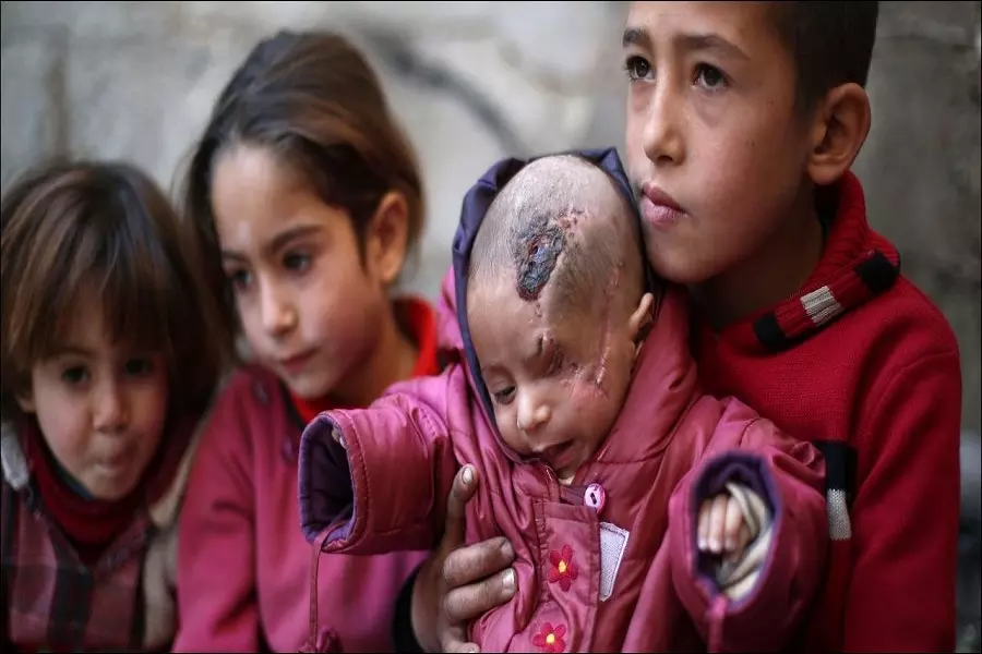 في اليوم العالمي للطفل .. أطفال سوريا بين "شهيد وجريح ومعذب"