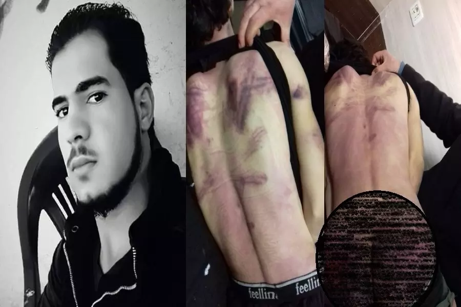 تعرض لتعذيب شديد بتهمة السرقة... مقتل مقاتل من القصير تعذيباً في سجون "فيلق الشام" بريف عفرين