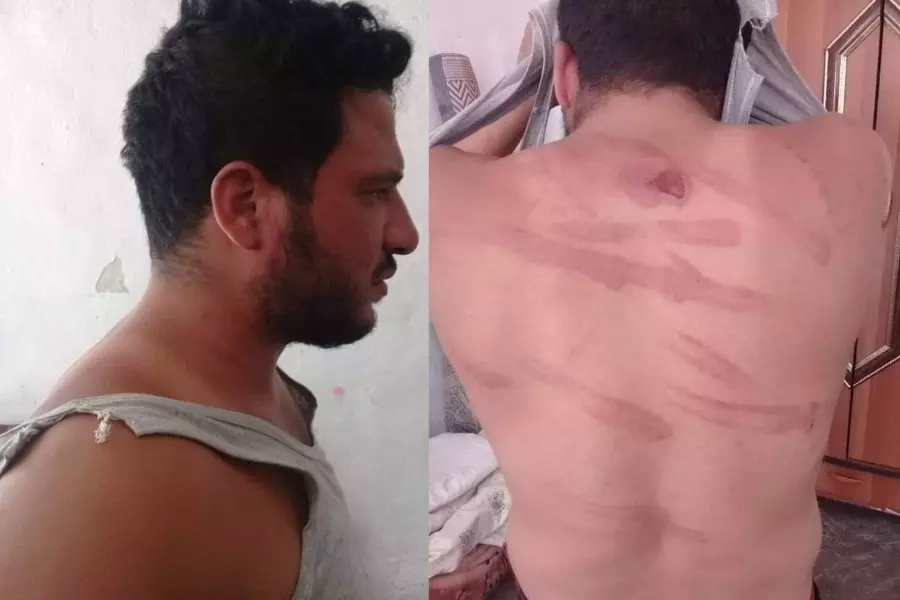 عناصر "قسد" ينهالون بالضرب على شاب طالب باسترداد أمواله في الرقة