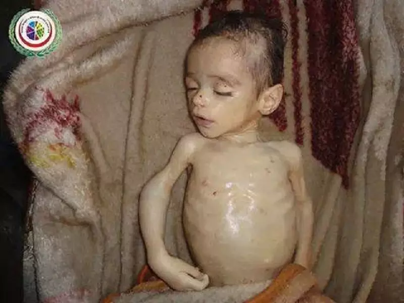 شهيد الجوع والحصار في غوطة دمشق