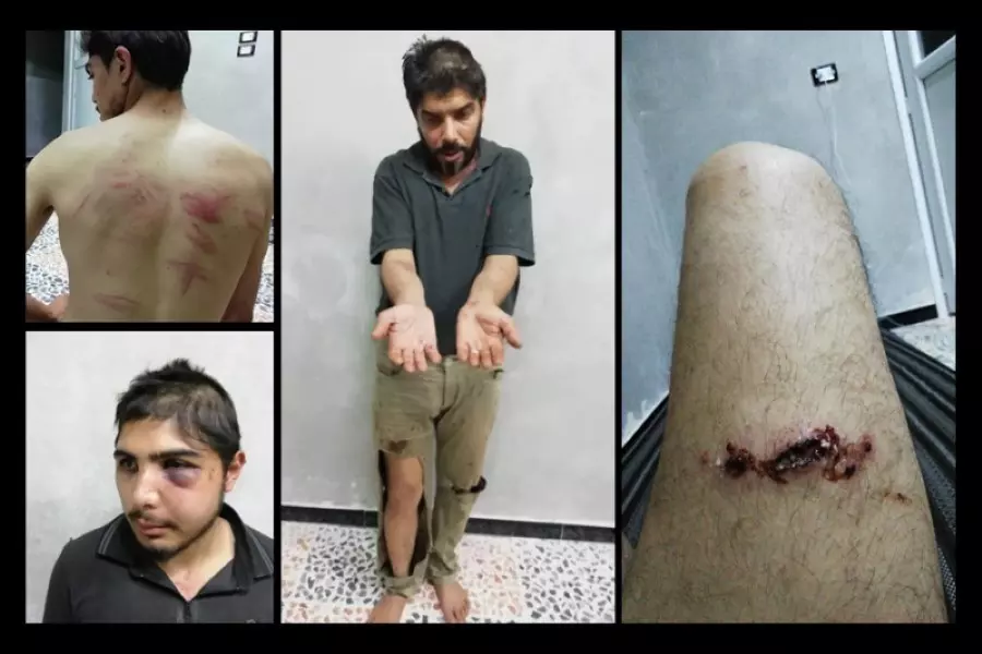 رابطة الإعلاميين في الغوطة الشرقية تدين قيام الجندرما التركية بتعذيب الناشط "مازن الشامي"