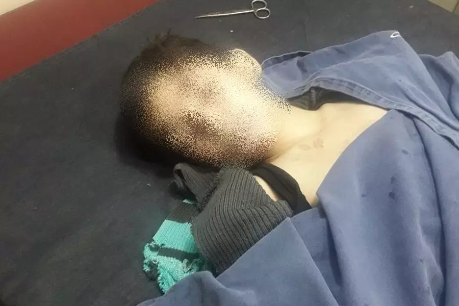 استشهاد طفل وجرح آخر بانفجار لغم من مخلفات النظام بحمص