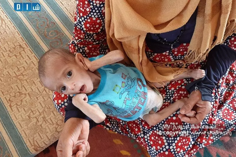 سوريا تتصدر قائمة الدول التي تعيش تحت خط الفقر بنسبة 82٪ من سكانها