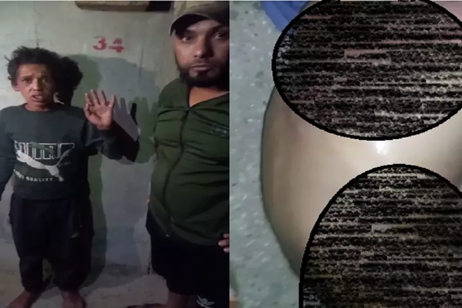 تعذيب وحشي لطفل برأس العين .. وفصيل يتنصل بنقل التهمة إلى عمه القيادي في جهاز الشرطة ..!!