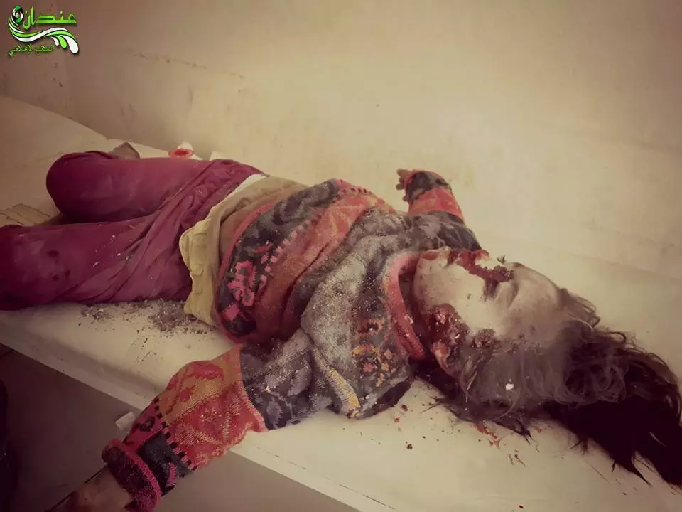 لم يشاهدوا مثيل لها خلال خمس سنوات .. أطباء مصدومون من حجم وحشية القصف على أجساد المدنيين