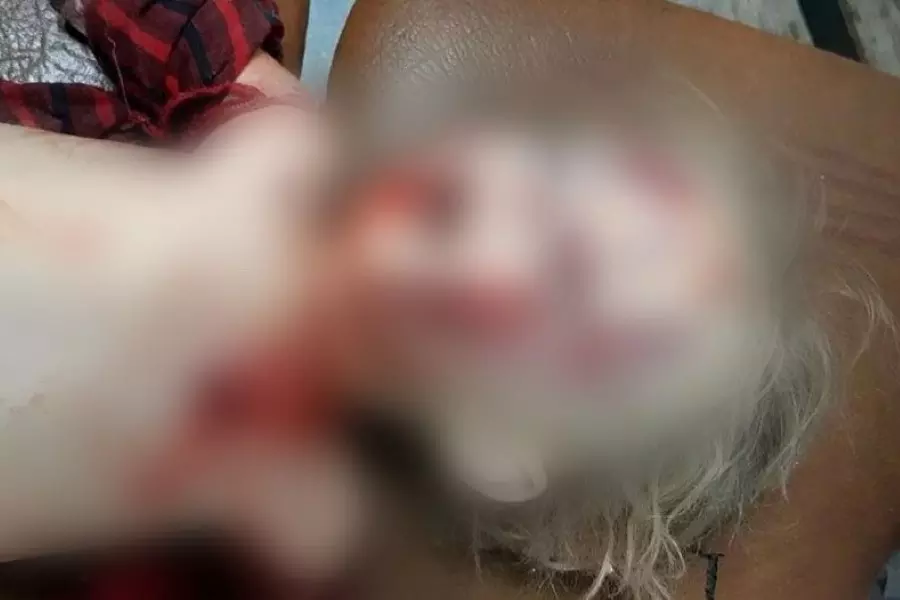 شهيدة طفلة بقصف مدفعي للنظام على قرية شنان بريف إدلب