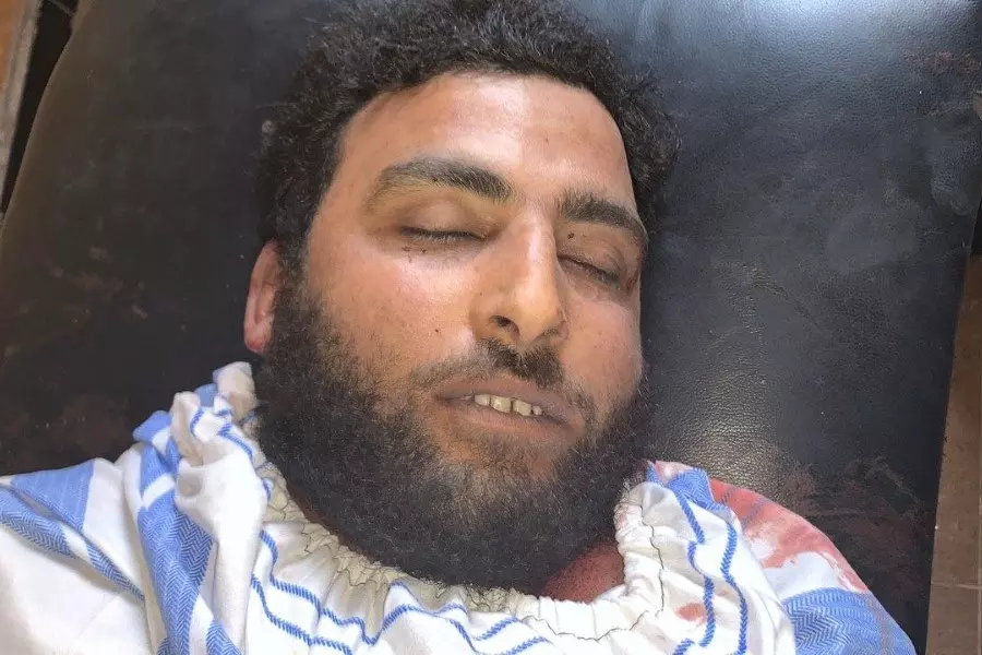 "جيش الشرقية" ينعي مقتل أحد عناصره برصاص جندي تركي ومطالب بالمحاسبة