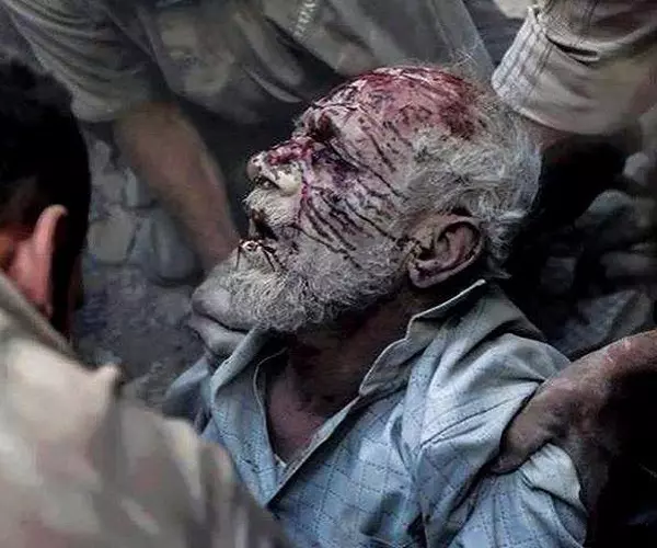 أطباء بلا حدود... الوضع الصحي في الغوطة تجاوز كل الخطوط الحمراء