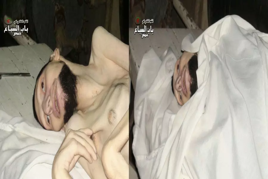 وفاة مدني في حي الوعر المحاصر نتيجة انعدام الدواء