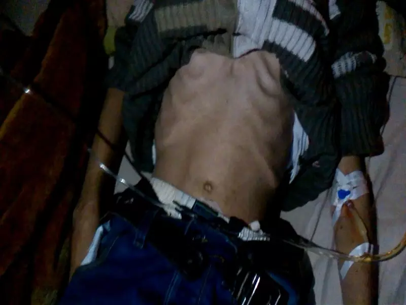 الجوع والمرض يحصدان المزيد من الأرواح في مضايا ..وفاة سيدتين من جديد