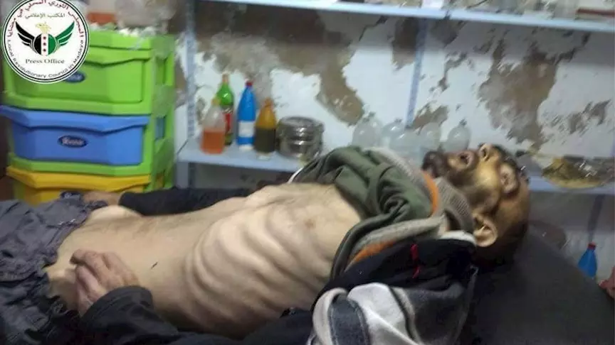 أطباء بلا حدود : ١٦ وفاة جديدة في مضايا و ٣٣ حالة في وضع خطر ... و النظام يواصل منع المساعدة