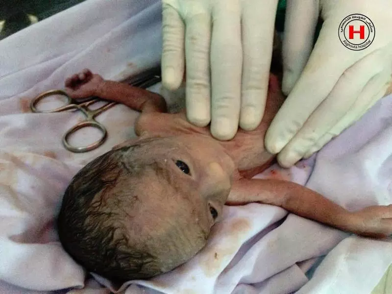 من جديد وفيتان.. نظام الأسد يتوّسع بالقتل البطيئ في "معضمية الشام"