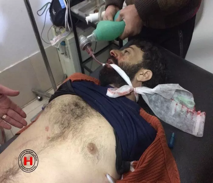 نشرة أخبار الساعة 8 صباحا لجميع الاحداث الميدانية في سوريا ليوم أمس 22-12-2015