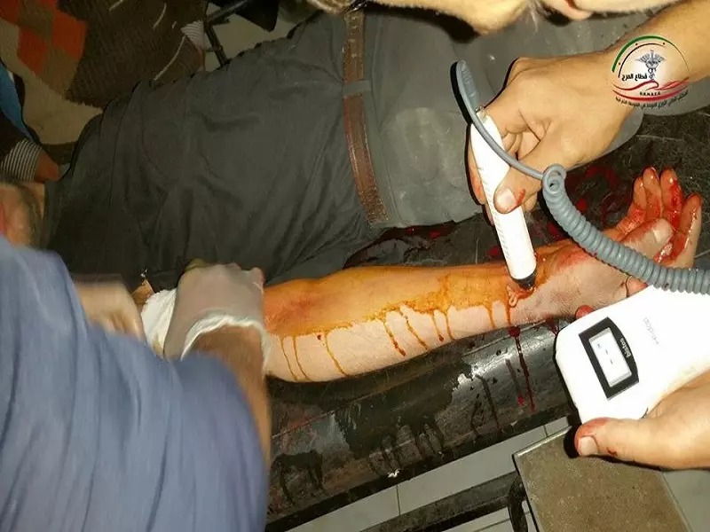 معارك على أطراف الغوطة الشرقية ... وقوات الأسد تقصف مدينة دوما وبلدة حرزما