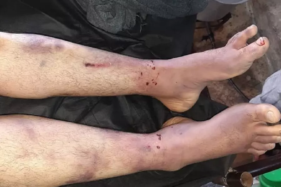 بعد ساعات من اعتقاله.. أمنية "فيلق. الشام" تُسلم جثة رجل مدني قضى "تحت التعذيب" في سجونها