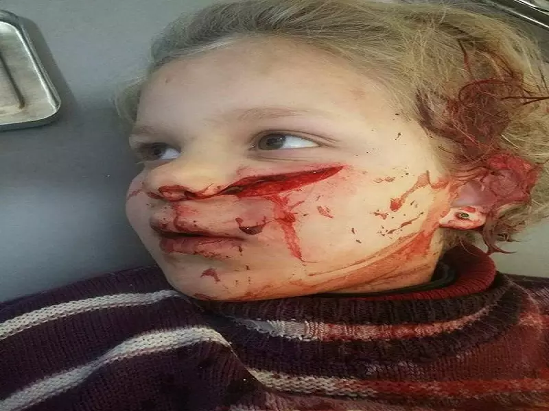 عشرات الشهداء في ريف حلب الشمالي وحركة نزوح مستمرة باتجاه الحدود