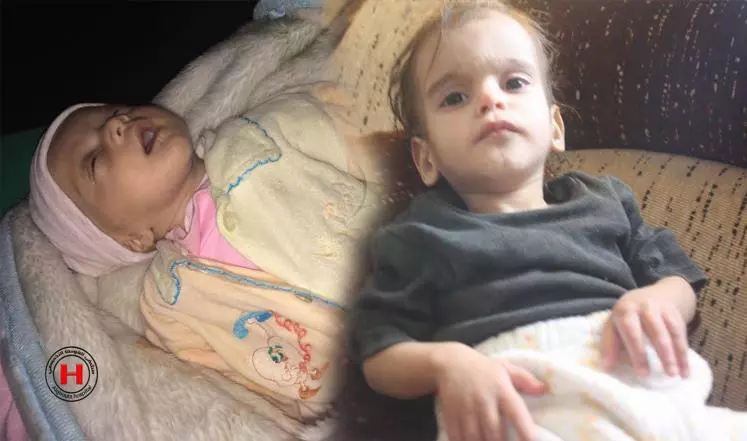 اليوم الأمم المتحدة تعلن عن حصار قوات الأسد لـ ٤٥ ألف مدني إضافي في المعضمية