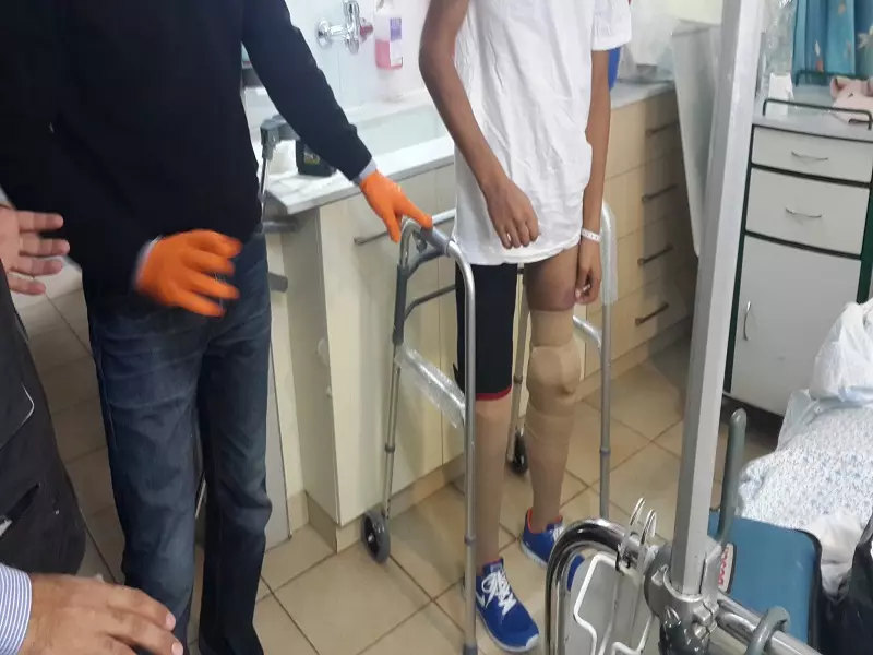 صناعة الأطراف الصناعية تعيد الأمل لفاقدي الأطراف في ريف حماة الشمالي