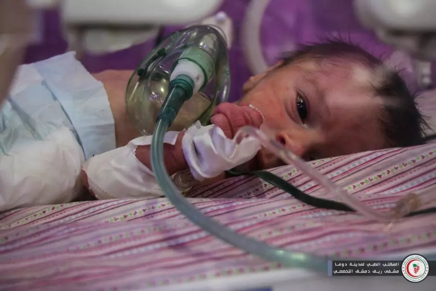 إجراء عملية جراحية لطفل مصاب بتشوه خلقي في الغوطة الشرقية المحاصرة