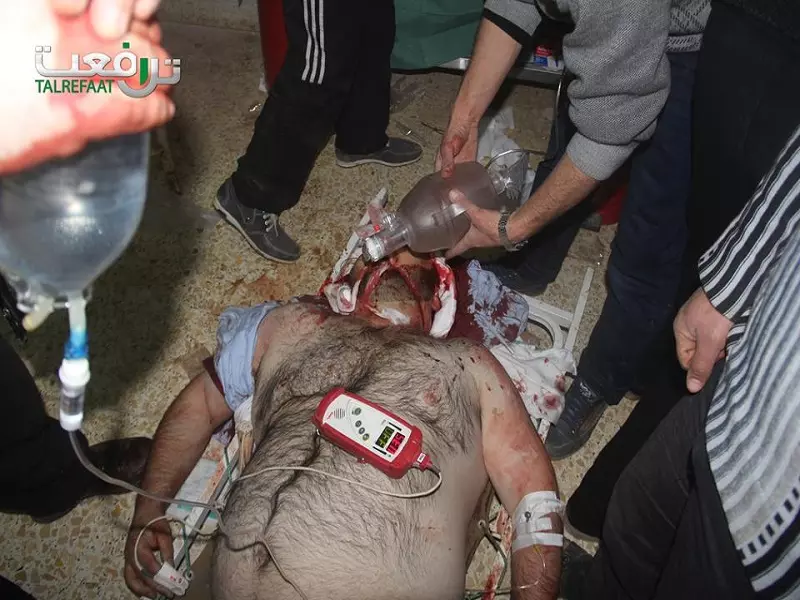 شهداء وجرحى بغارات روسية استهدفت تل رفعت ليلاً