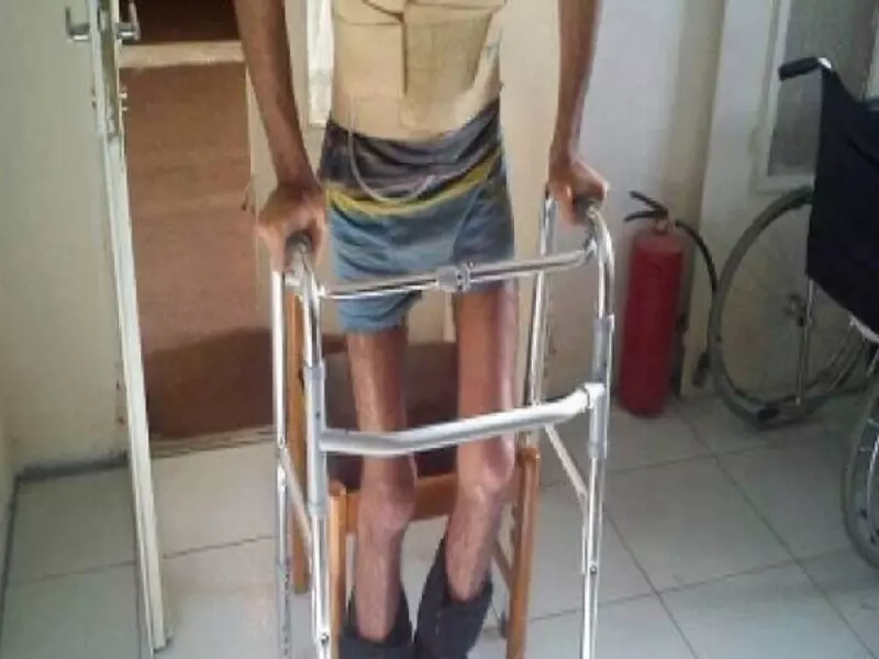 مركز تأهيل صحي صغير يعيد الأمل لمصابي سوريا بالأردن