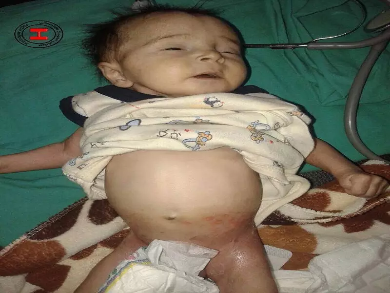 أوضاع إنسانية صعبة تعيشها مدينة معضمية الشام نتيجة حصار مطبق