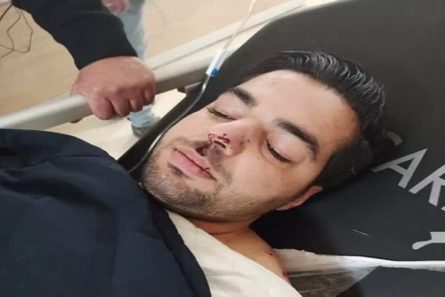 إصابة الإعلامي "بهاء الحلبي" إثر محاولة اغتيال طالته في "الباب"