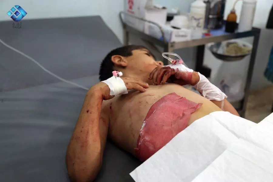 قوات سوريا الديمقراطية تستهدف المدنيين شمال حلب ... والمدفعية التركية ترد