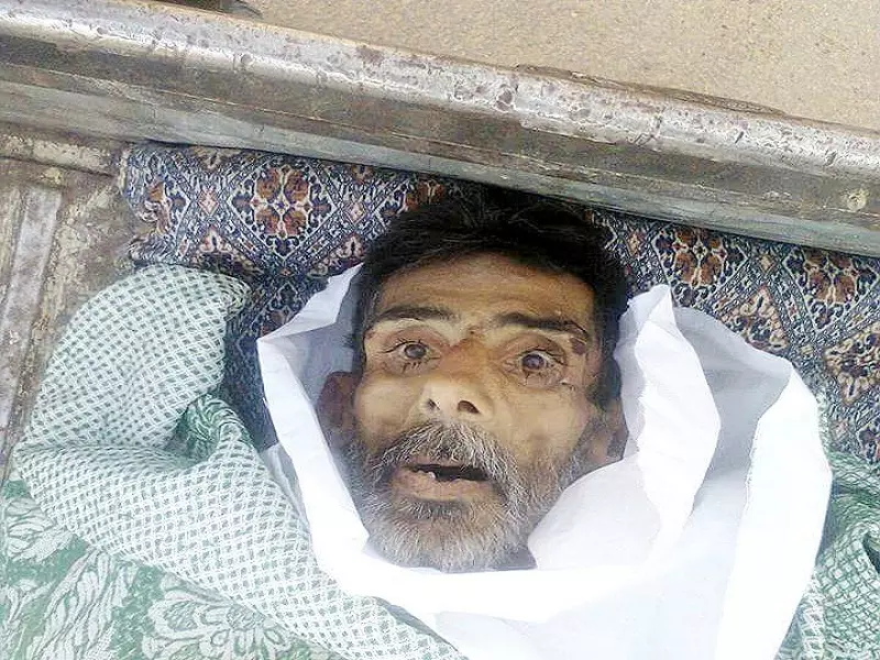 الوفاة جوعا ومرضا لشخصين من مضايا