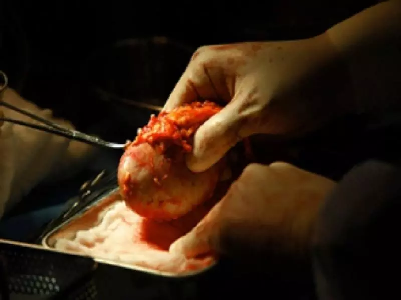 أعضاء السوريين .. "سلعة" رابحة  لأطباء الأسد و الروس و الإيرانيين!!