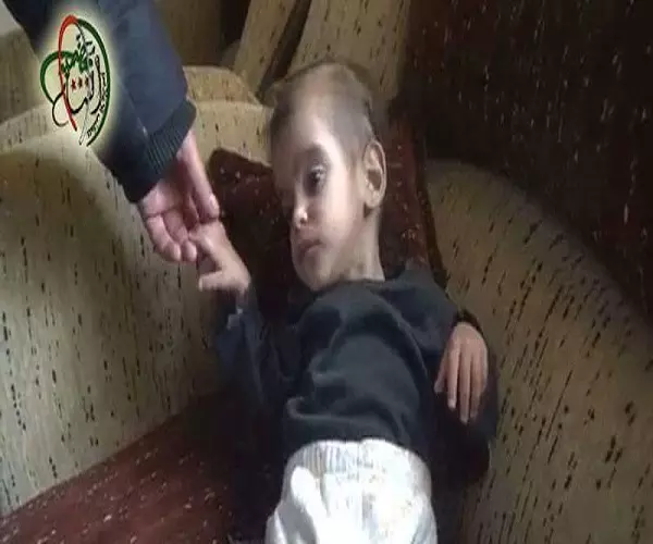 الأمم المتحدة ... 18 منطقة سورية لا يمكن الوصول إليها