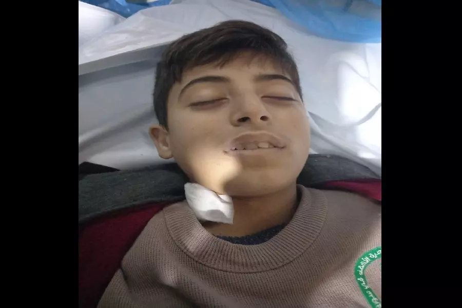 مقتل طفل برصاص الجندرما التركية قرب مخيمات عين البيضا بريف إدلب