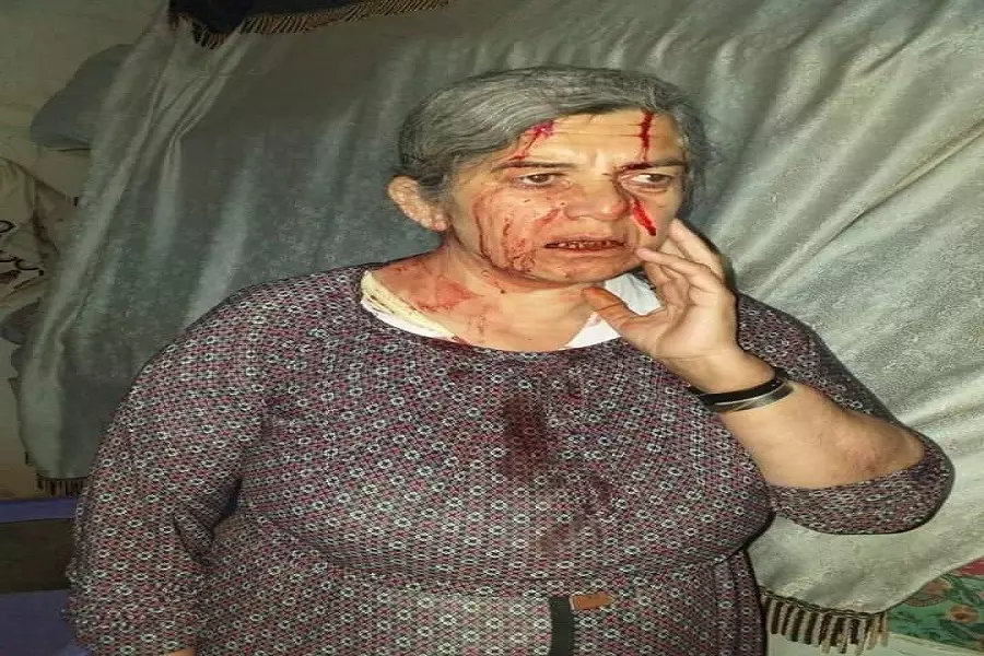 ميليشيا "ب ي د" تعتقل رجل مسن وتعتدي على زوجته بالضرب بالحسكة