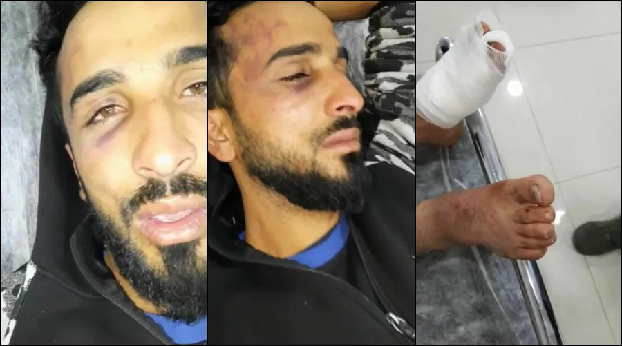 تعذيب شاب ورميه في الشارع .. أمنية "سليمان شاه" تواصل انتهاكاتها بريف عفرين