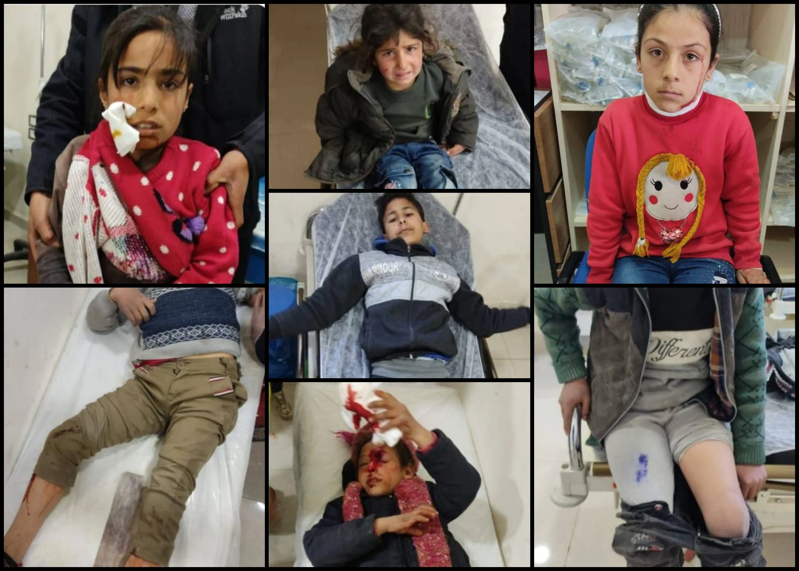 وسط استهتار "الجيش الوطني" .. إصابة 8 أطفال بشظايا رشاشات ثقيلة بريف عفرين