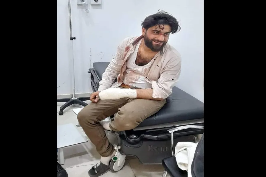 عناصر "عاصفة الشمال" يعتدون بالضرب على ناشط ومنشد ثوري بمدينة إعزاز