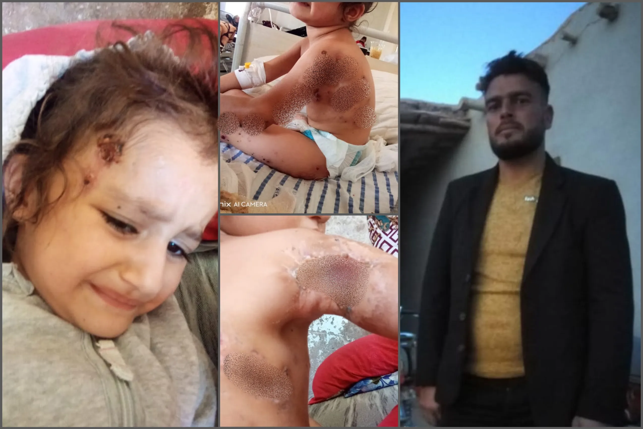 اعتقلت الأب وهددت ذويه ... عائلة كردية ضحية ألغام "قسد" بـ "عين العرب" وهذه قصتها