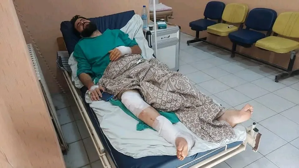 كسر يضاف لإصابات حربية .. "أمنية الشامية" تعتدي على ضابط منشق ووعود المحاسبة تتلاشى..!!