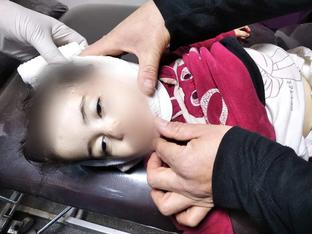شهيدة طفلة وإصابة سيدة بقصف مدفعي لقوات الأسد استهدف مدينة إدلب 